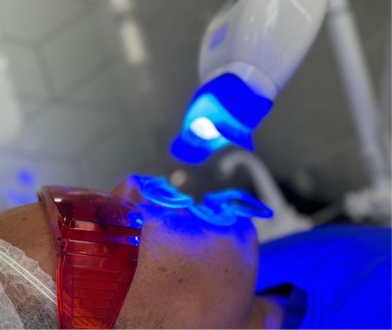 blanqueamiento dental